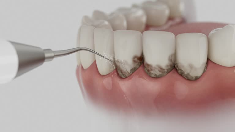 Reliable Dental contractor in Carlisle, OH by Dentist Open Now